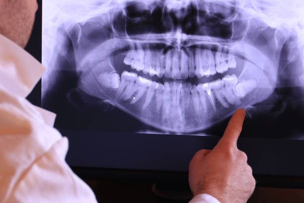 Best Emergency Treatment for Toothache in Poulsbo, WA