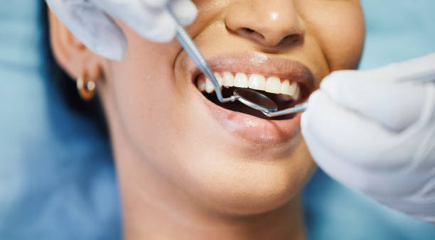 Best Emergency Tooth Extraction in Poulsbo, WA